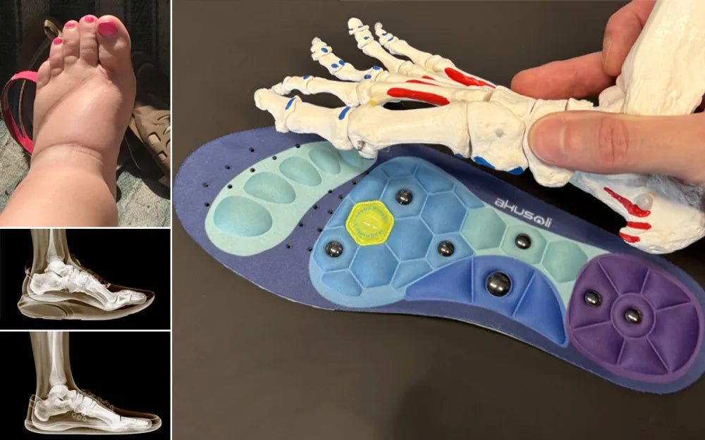 10 Reasons Why These Doctor-Recommended Insoles Are Becoming The #1 Trending Health Investment